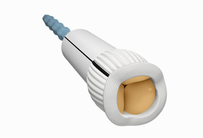 KONECT RESILIA aortic valved conduit
