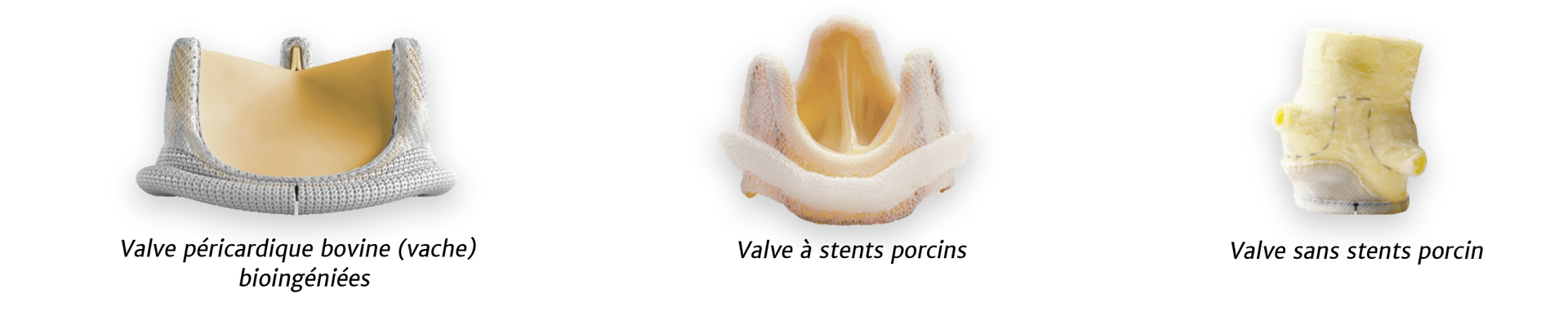 bioprosthetic valves