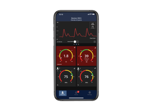 Viewfinder remote app