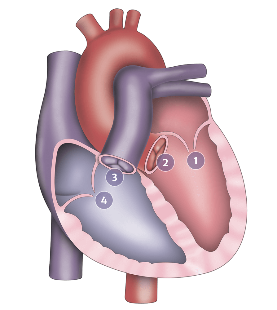 What is heart valve disease