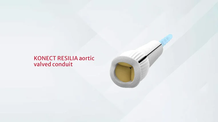 KONECT RESILIA aortic valved conduit