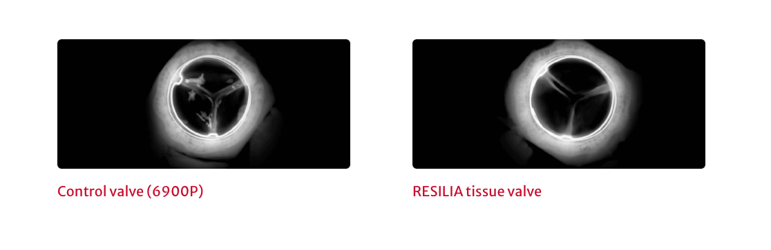 resilia-tissue-comparison