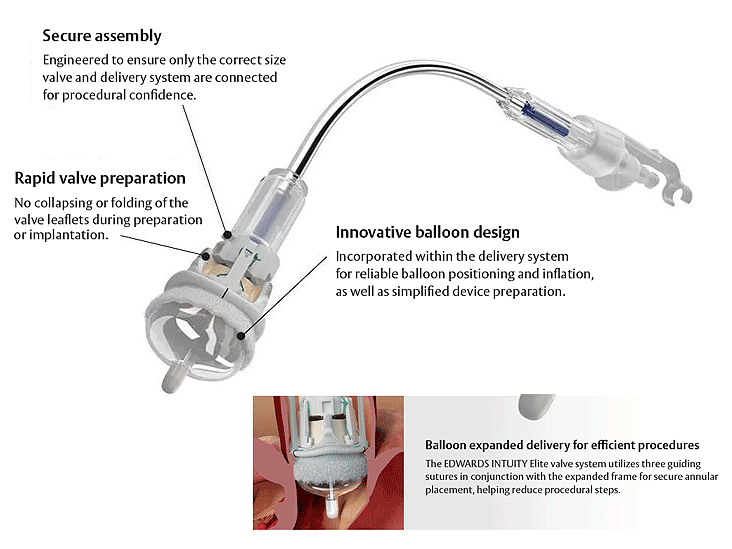 valve system