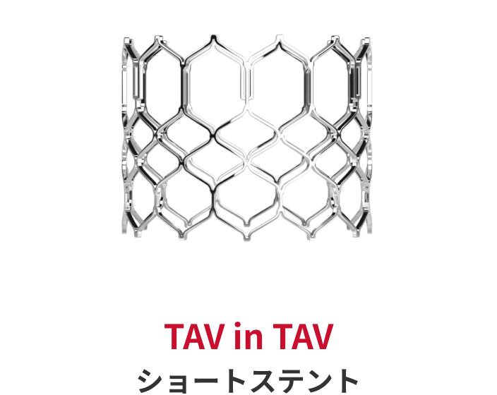 capsularvalve