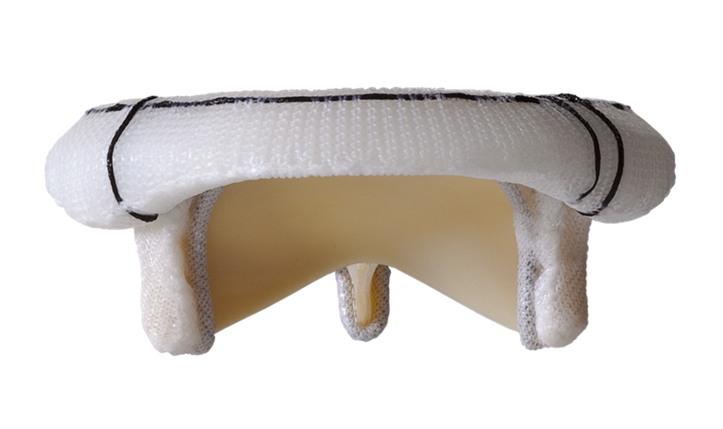 magna perimount thumbnail