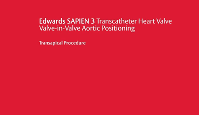 Transcatheter SAPIEN 3 TAVR gallery item 4
