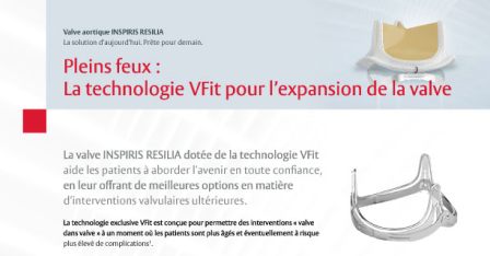 INSPIRIS RESILIA aortic valve brochure