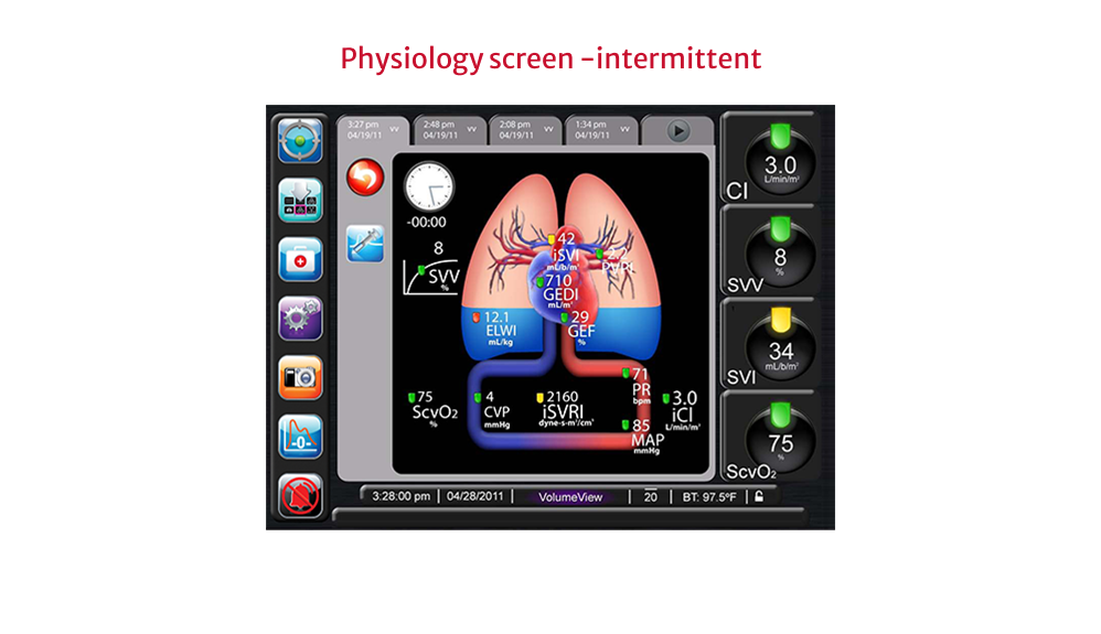 Volumeview Lung