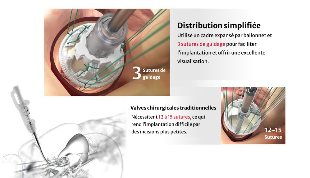 streamlined delivery