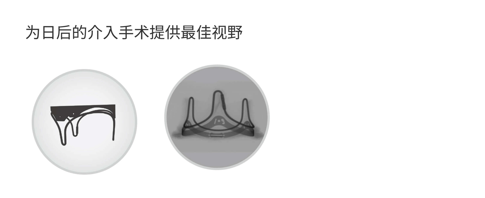 Delivering the best visibility for future interventions