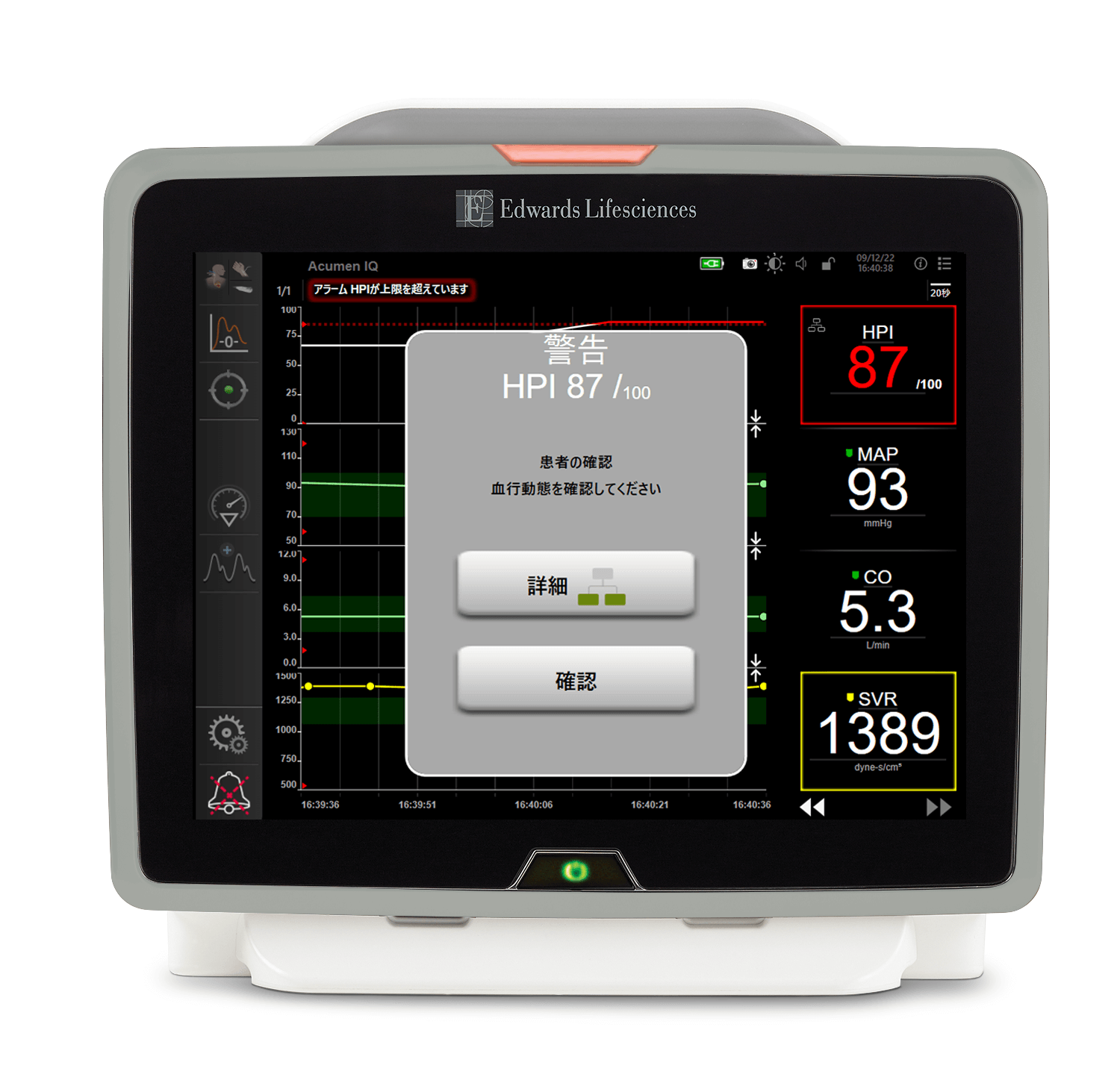 HPI Parameter