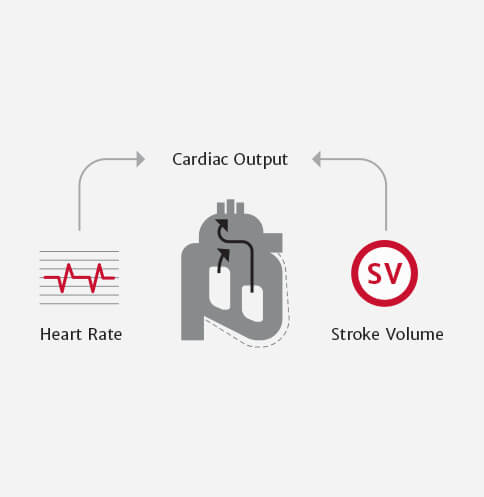 Cardiac Output diagram