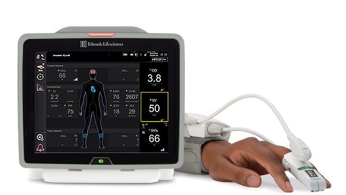 Acumen IQ cuff is available on the HemoSphere advanced monitoring platform