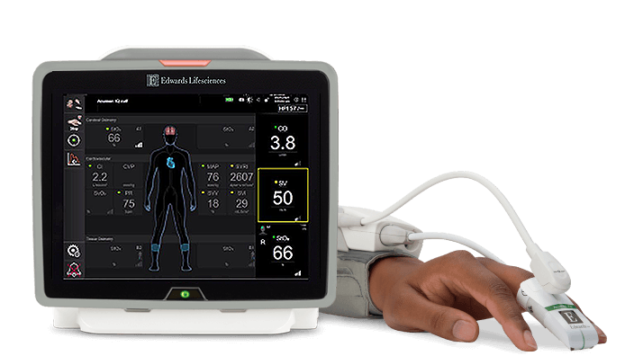 Monitor and Acumen IQ cuff