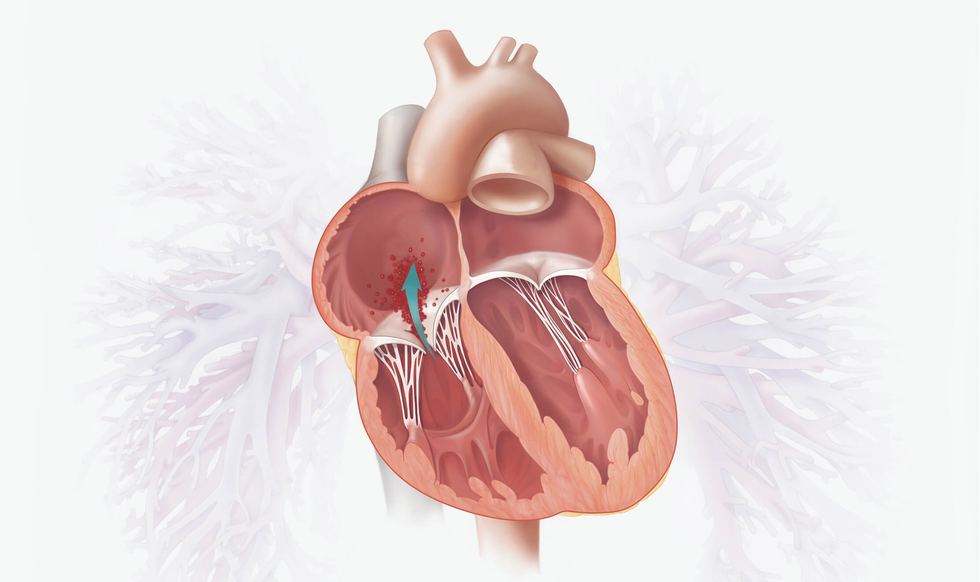Prevalence and Importance of Addressing TR