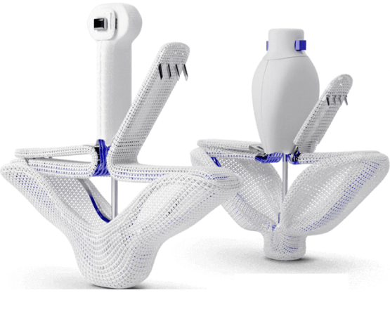 The PASCAL Implant