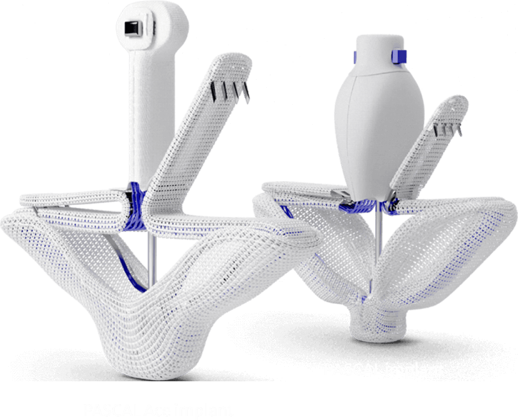 The PASCAL Implant