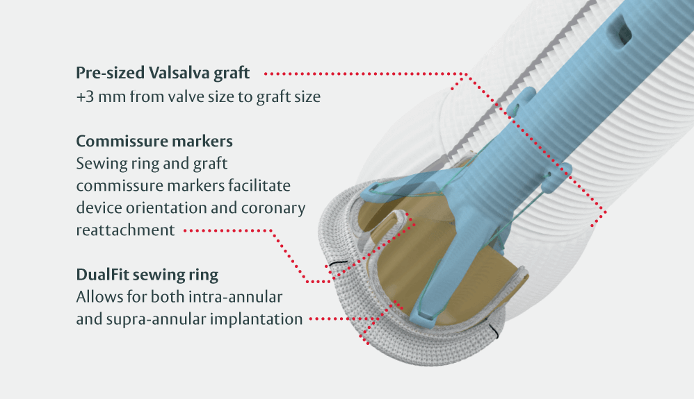 gelweave valsalva graft