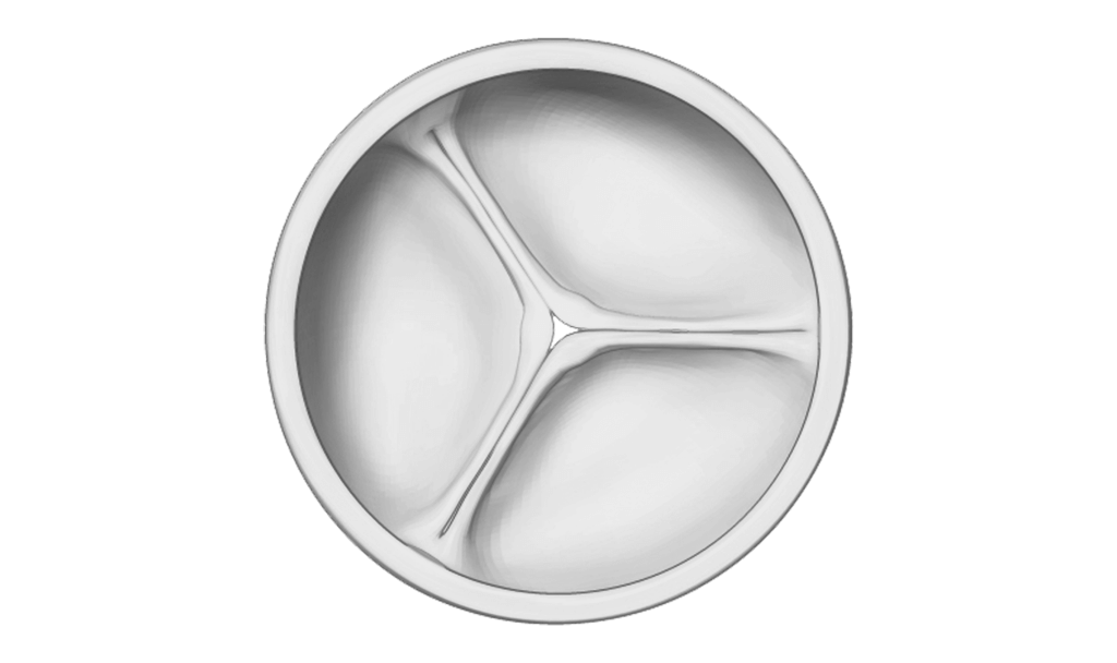 healthy aortic valve