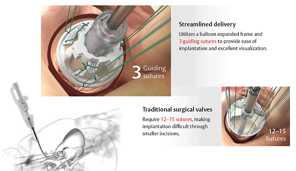 streamlined delivery