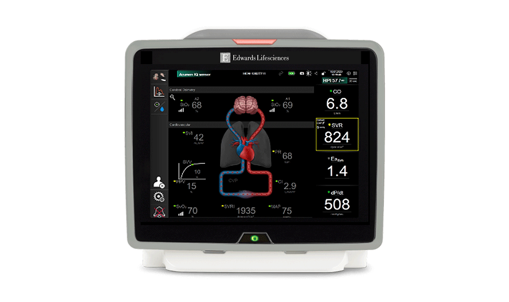hemosphere monitor