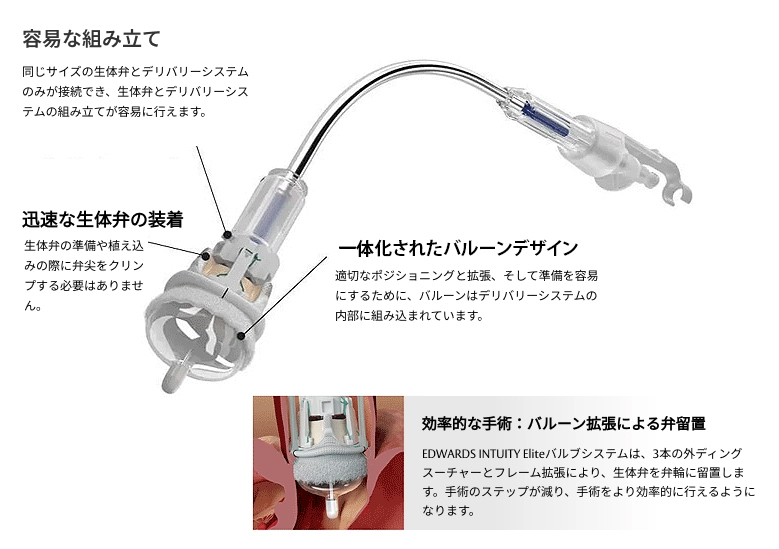 valve system
