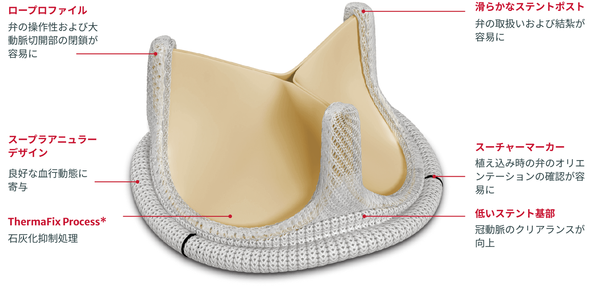 magna ease features