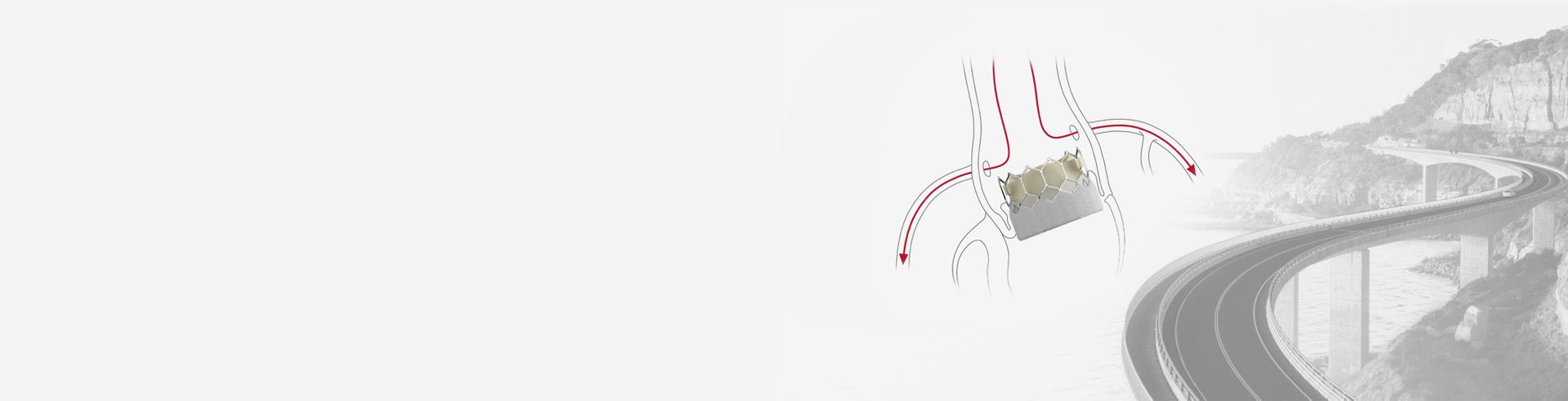coronary access background