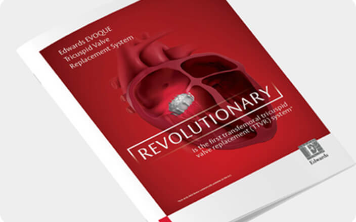 Product brochure