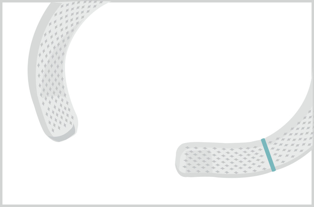 open segment