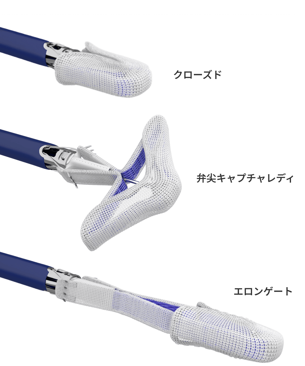 Versatile implant configuration image
