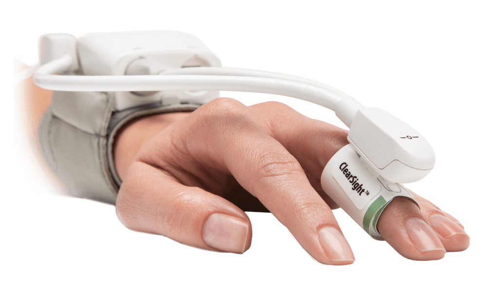 ClearSight finger cuff
