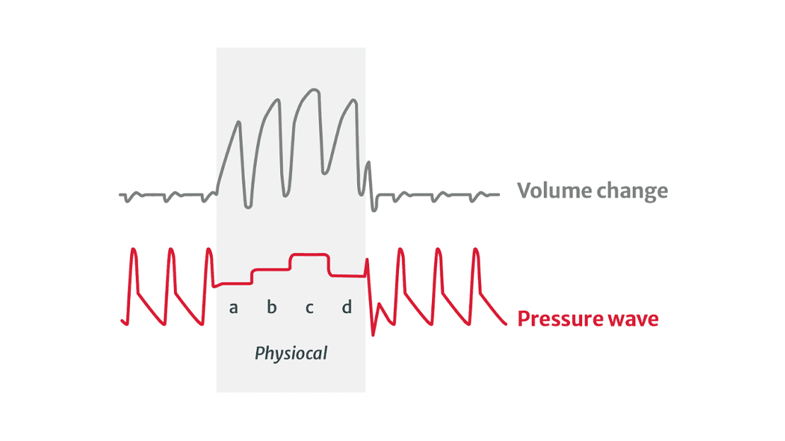 Physiological calibration