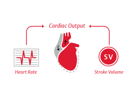 Cardiac Output (CO) = Stroke Volume x Heart Rate