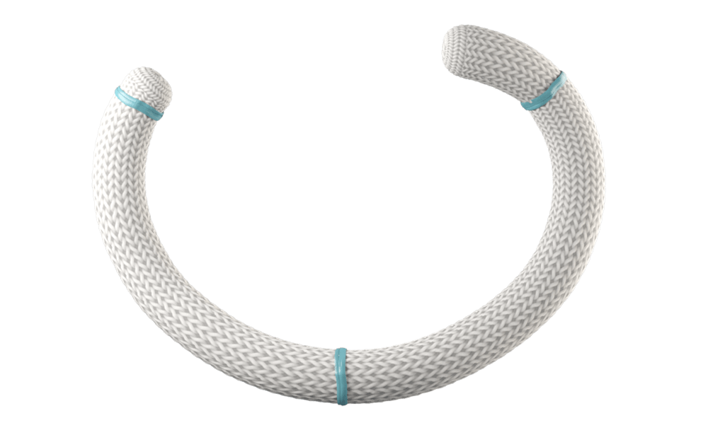mitral annuloplasty