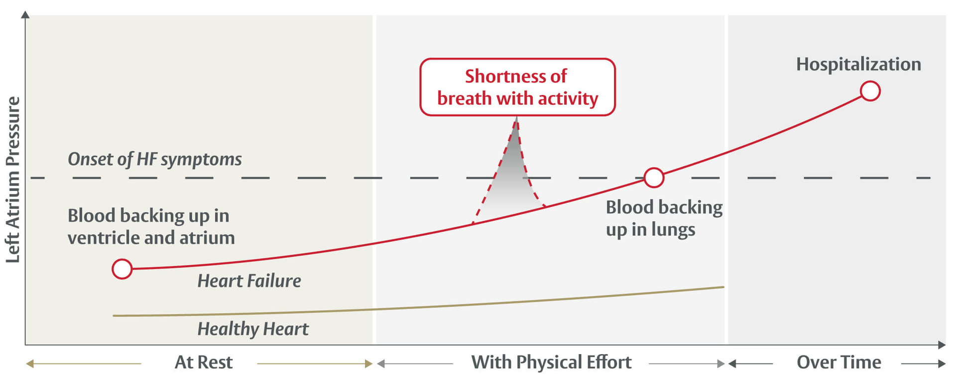 Heart failure chart
