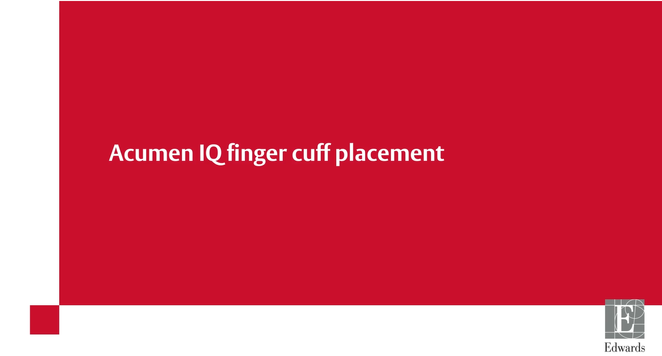 Acumen IQ finger cuff placement