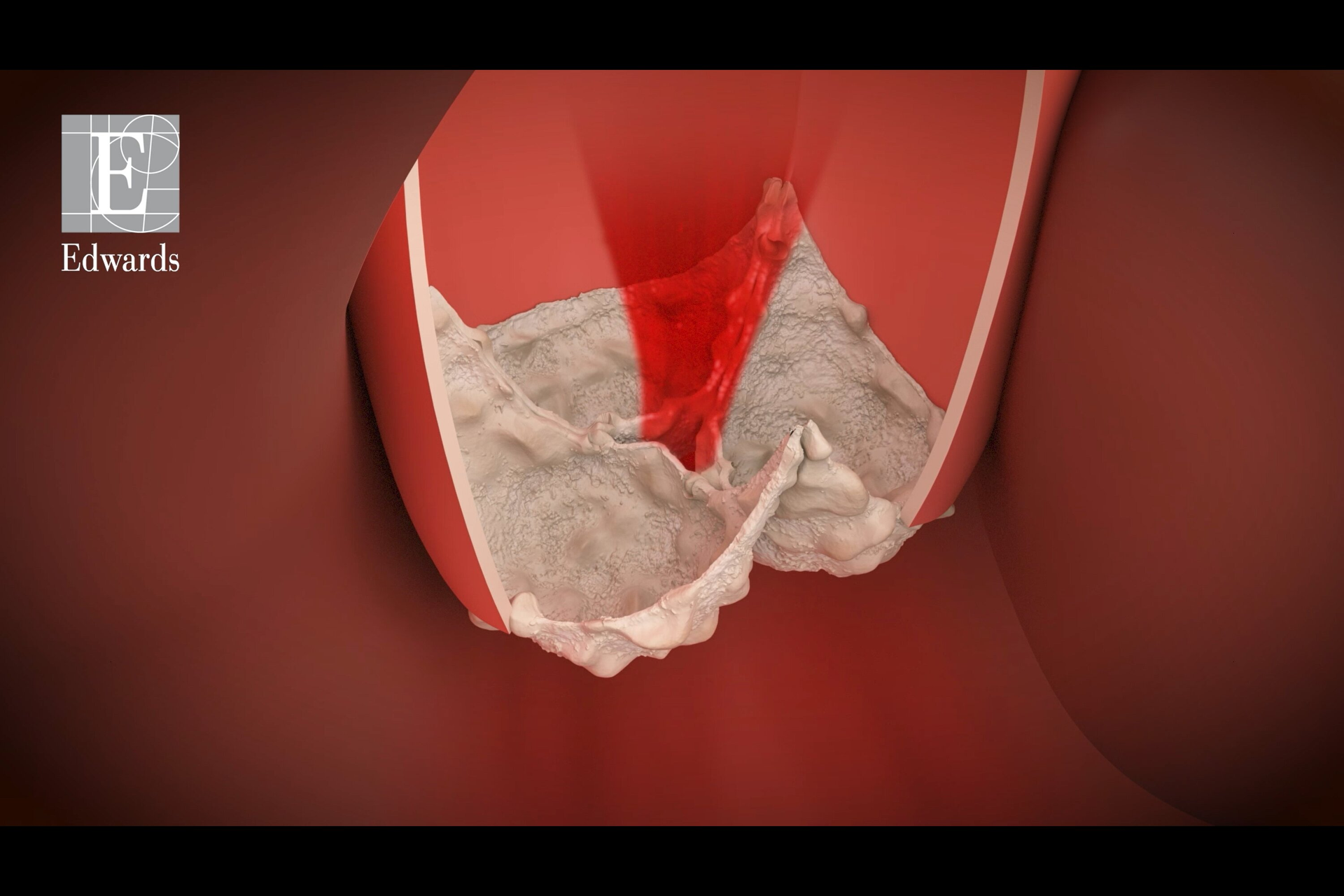 Explanatory video