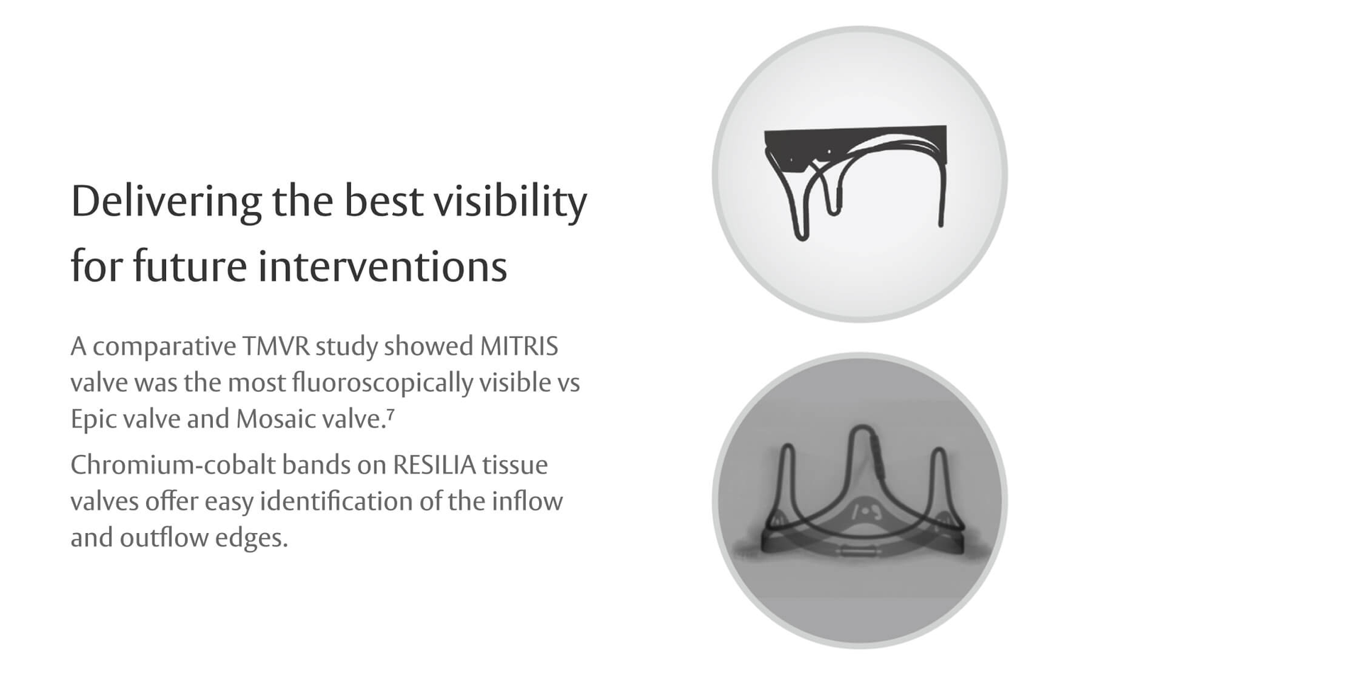 Delivering the best visibility for future interventions