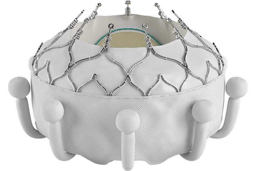 transcatheter tricuspid valve
