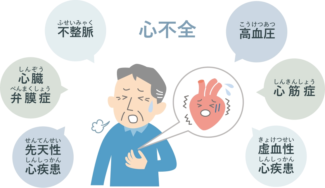 Heart valve disease can lead to heart failure