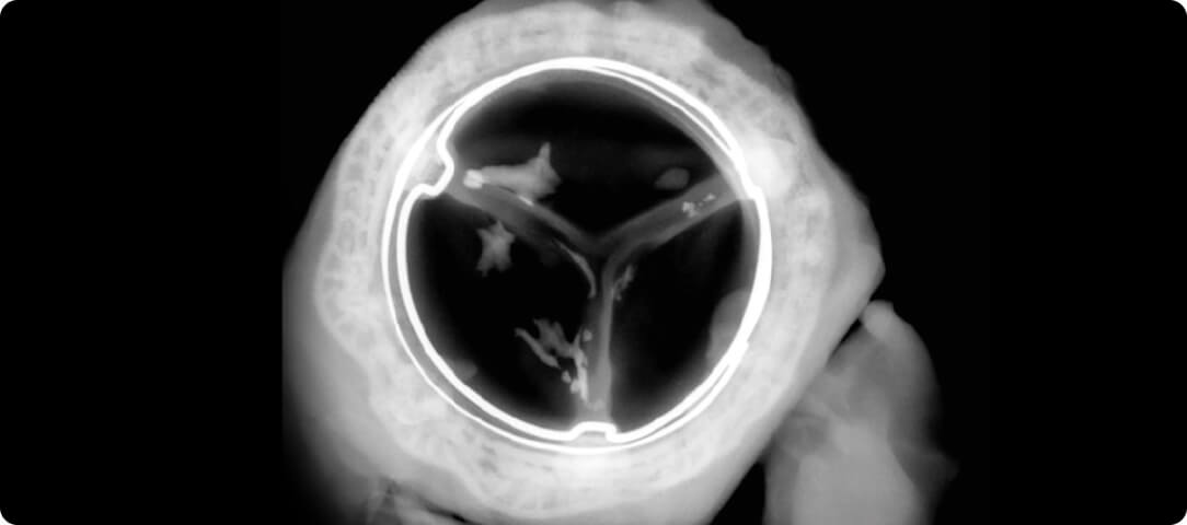 Control tissue valve