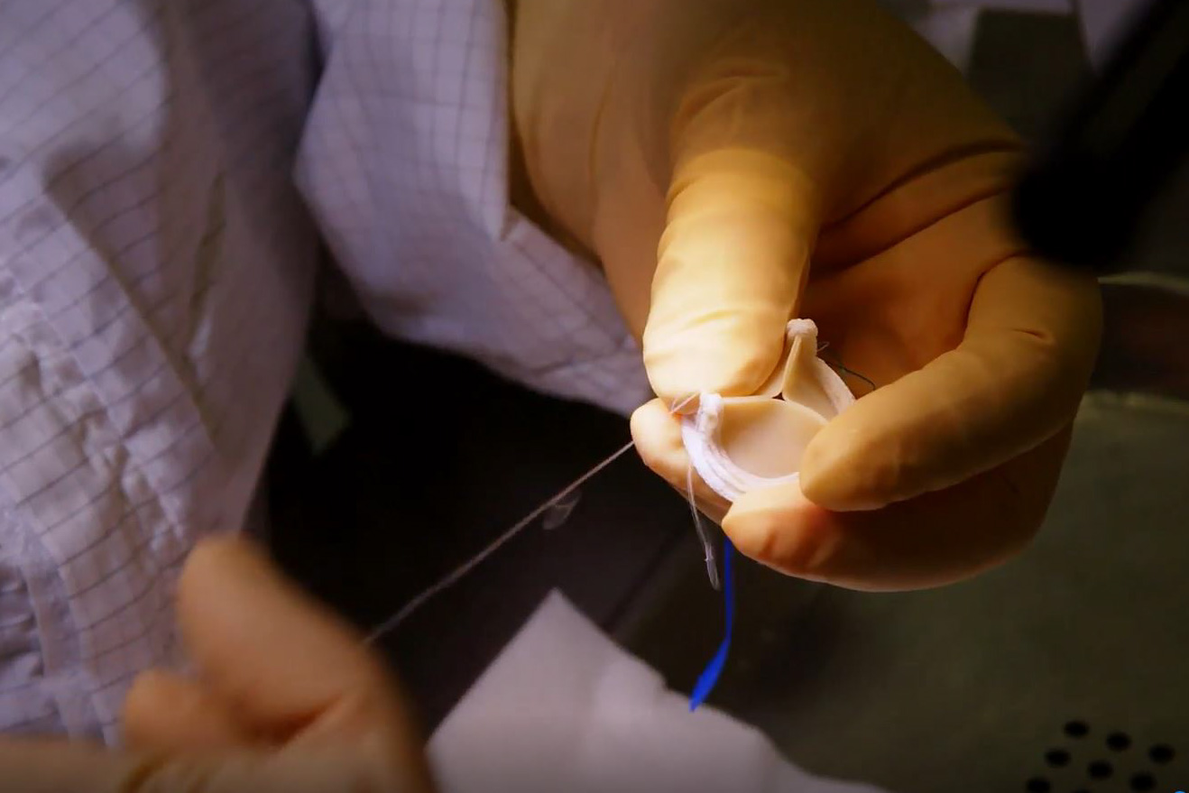 Heart valve image