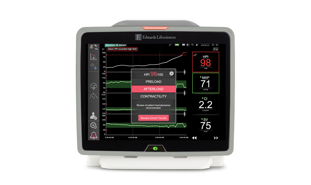 Acumen Hypotension Prediction Index (HPI) software