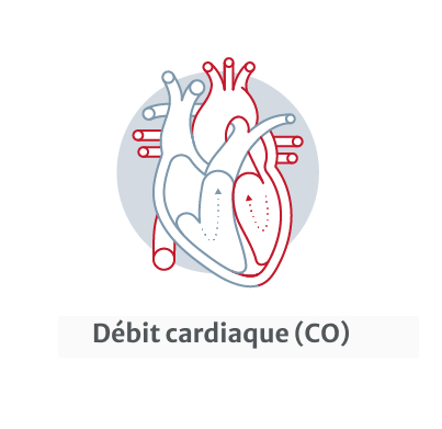 cardiac output