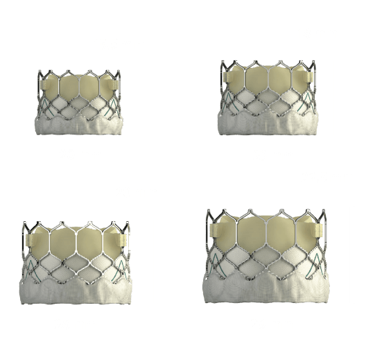 SAPIEN 3 valve sizes Image