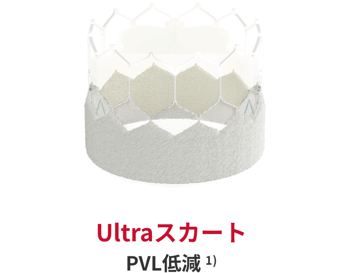 ultraskirt