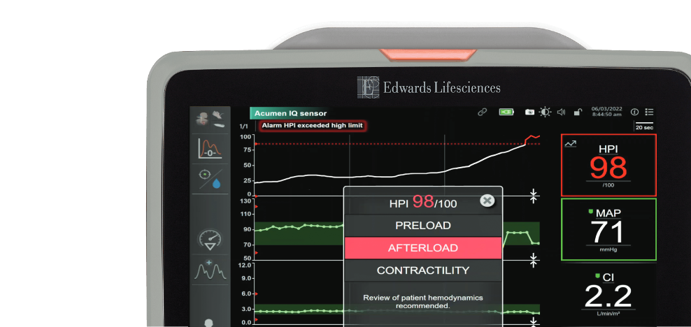 Acumen HPI software