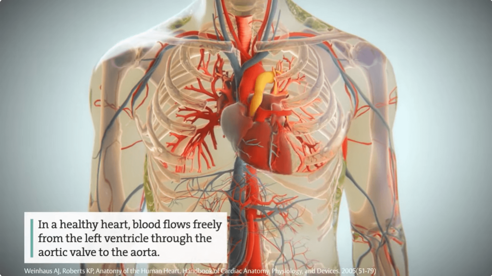 Aortic Stenosis