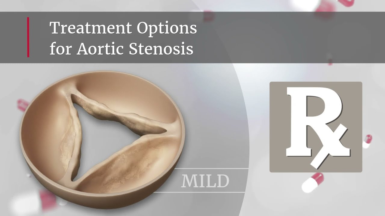 Treatment option for aortic stenosis